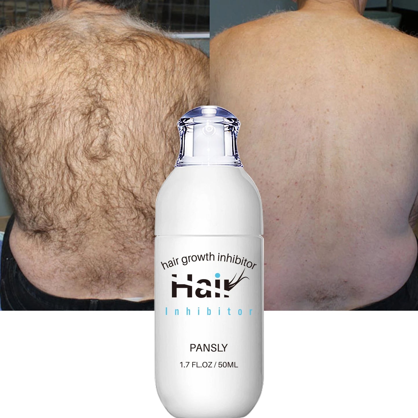 SilkSkin™ Spray Depilador
