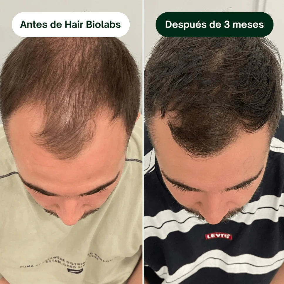 Suero Anticaida para el Cabello 60ml 2X1