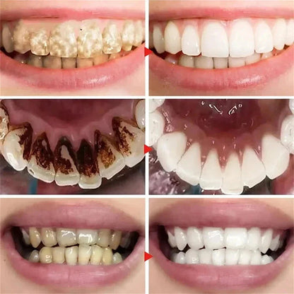 Espuma Blanqueadora Dental Púrpura