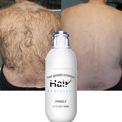 SilkSkin™ Spray Depilador