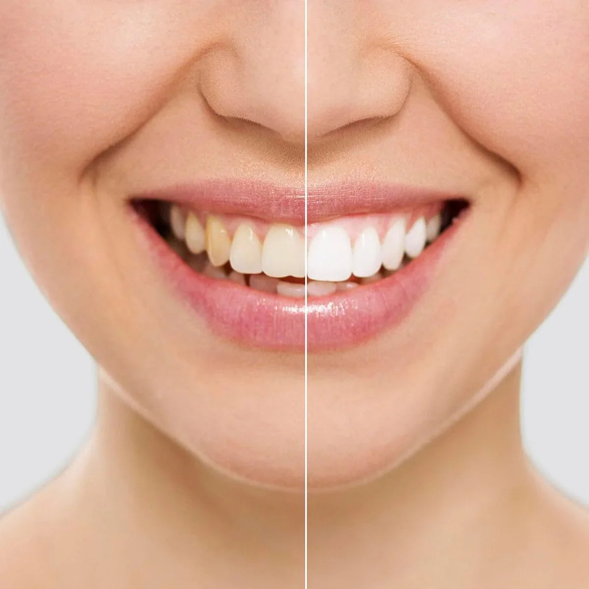 Tiras Blanquedoras Dentales