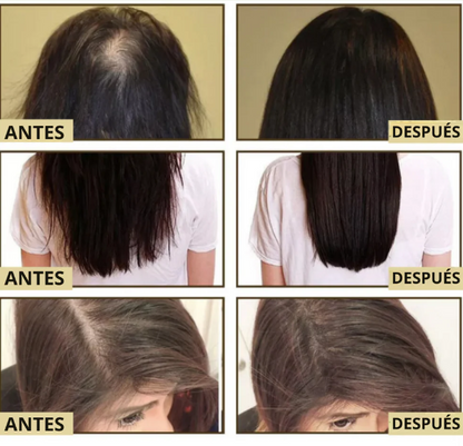 Aceite Capilar Vegano