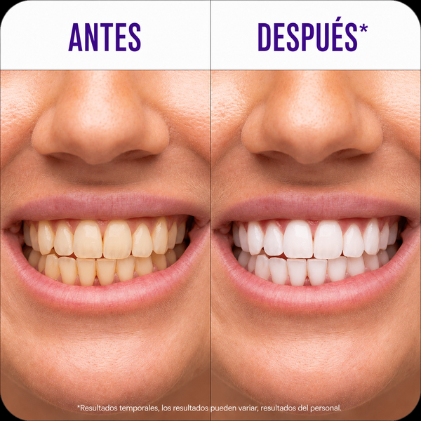Tiras Blanqueadoras Sorprendentes