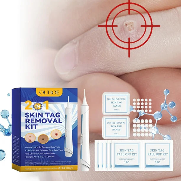 DermaCare™ Kit Corrector de Verrugas de Alta Precisión