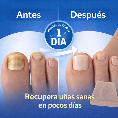 NailGuard™ Parches Antihongos para Uñas