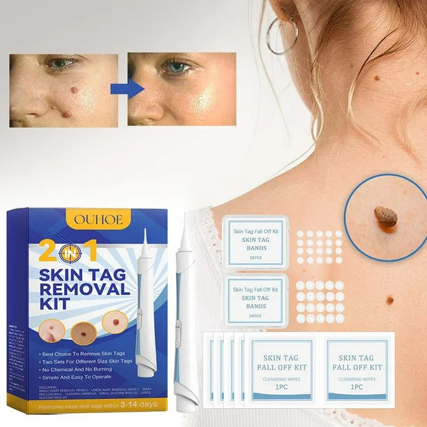 DermaCare™ Kit Corrector de Verrugas de Alta Precisión