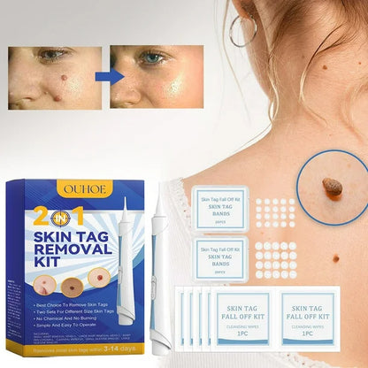 DermaCare™ Kit Corrector de Verrugas de Alta Precisión